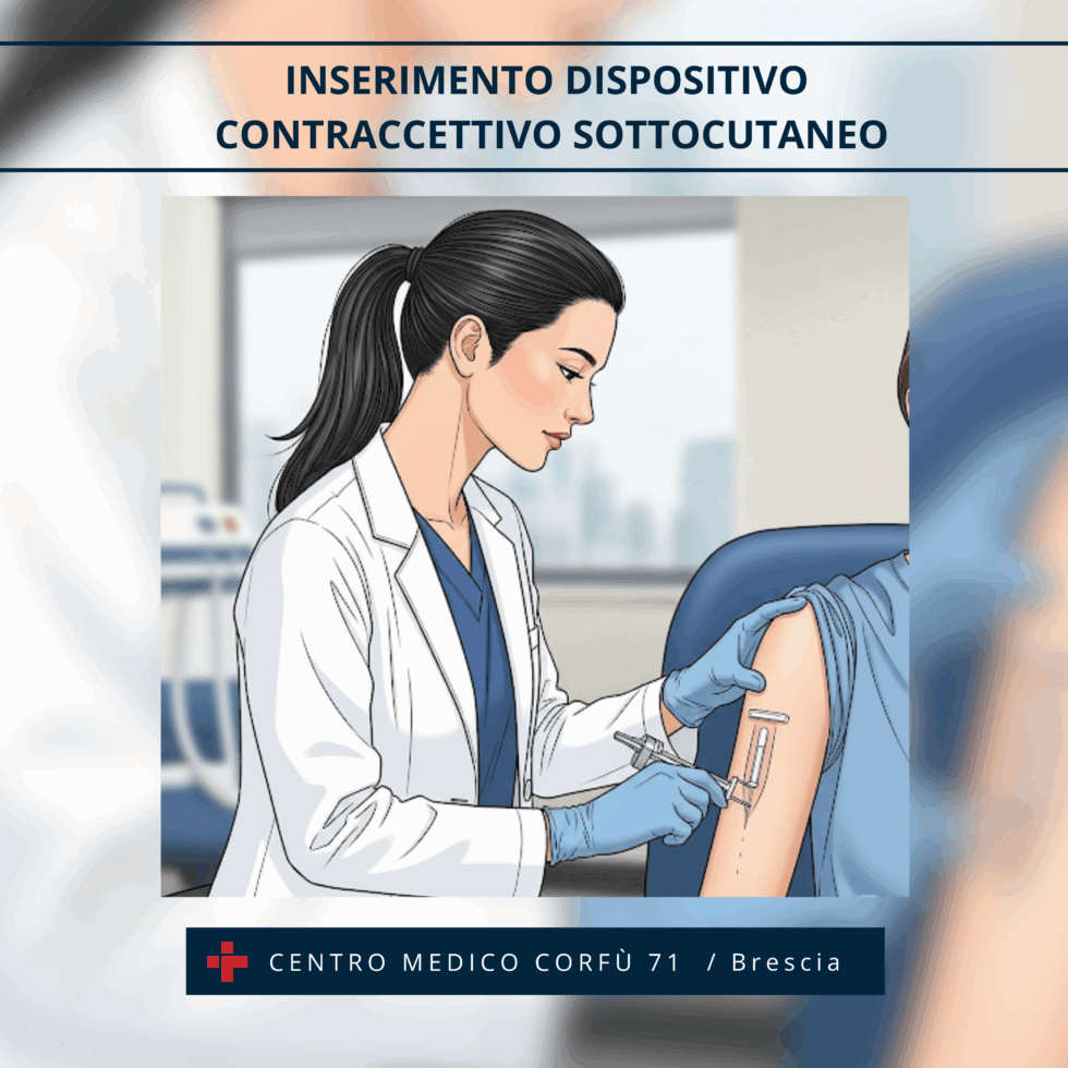 INSERIMENTO IMPIANTO CONTRACCETTIVO SOTTOCUTANEO