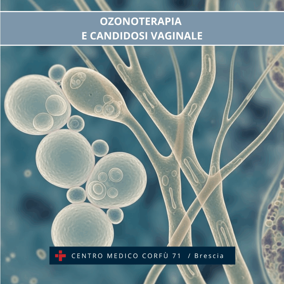 OZONOTERAPIA E CANDIDOSI VAGINALE