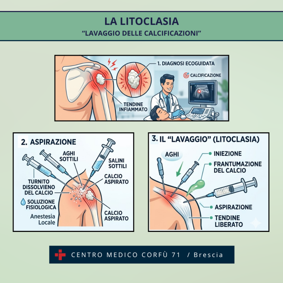 LA LITOCLASIA