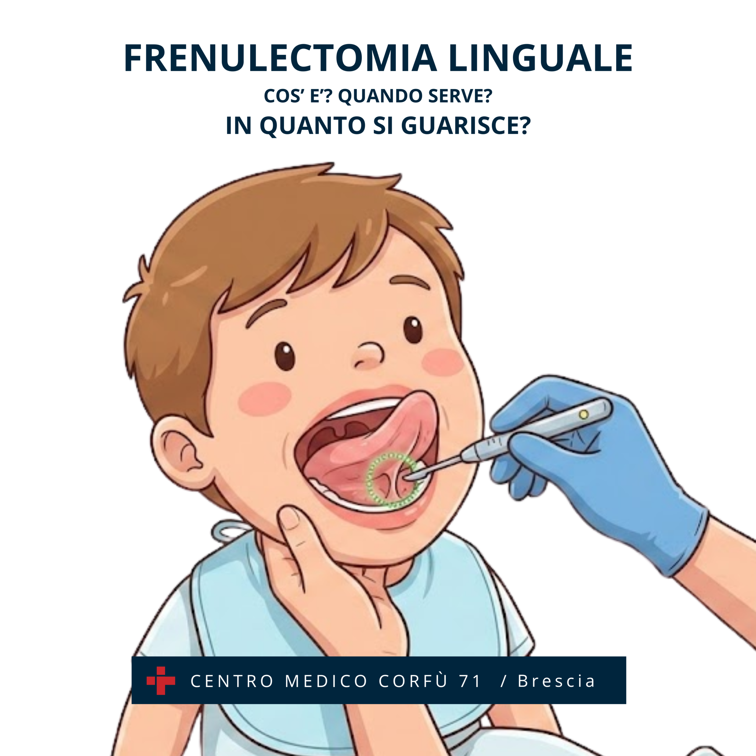 frenulectomia