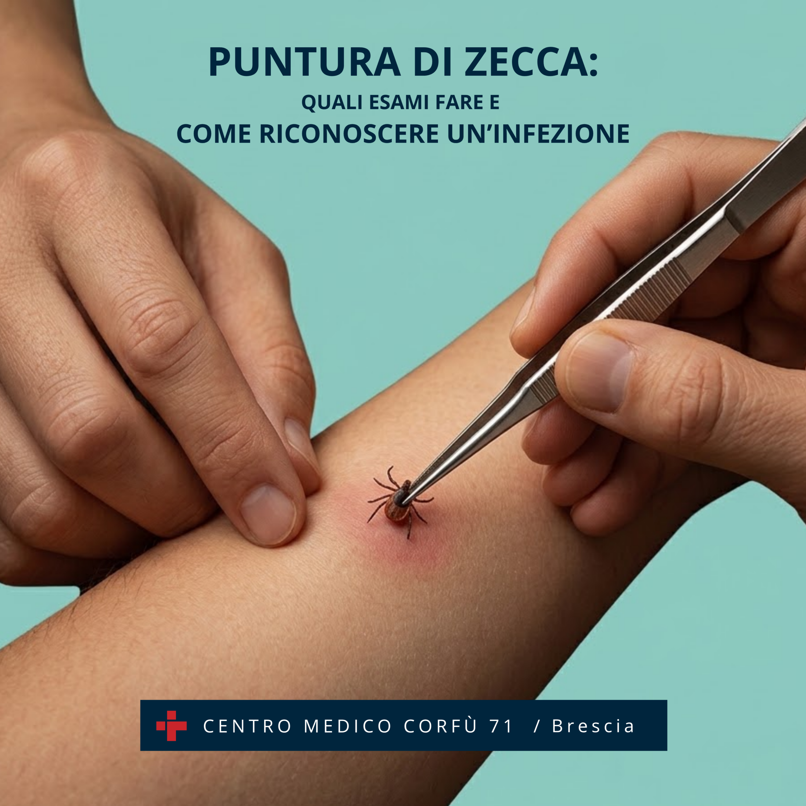 puntura di zecca